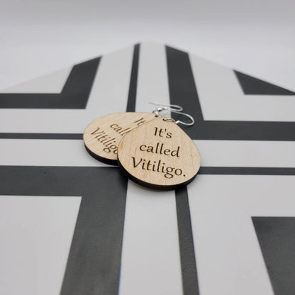 The Tiffany Vitiligo Earrings (round) - 4 Arrows Creations